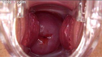 1 Silvie Irsilvie Irish Model Gaping And Stretching52 thumbnail