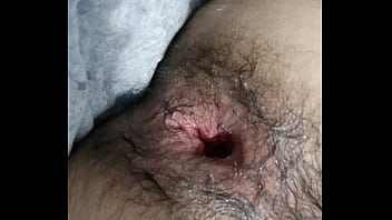 Anal Fist Y Dilatado thumbnail