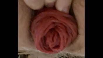 Anal Fisting Broken Asshole thumbnail