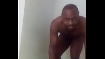 Reintroducing my naturally vitiligo looking anus