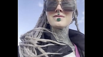 Do You Want To Know Why I Wear The Plasters This Is Shortly After My Implant Body Modification Project After 1 thumbnail