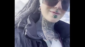 Do you want to know why i wear the plasters this is shortly after my implant body modification project after 1 Do you want to know why i wear the plasters this is shortly after my implant body modification project after 1
