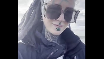 Do you want to know why i wear the plasters this is shortly after my implant body modification project after 1 Do you want to know why i wear the plasters this is shortly after my implant body modification project after 1