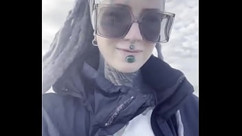 Do you want to know why i wear the plasters this is shortly after my implant body modification project after 1