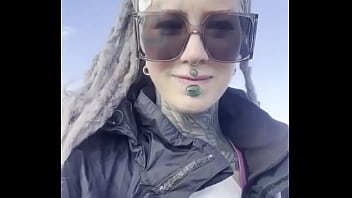 Do you want to know why i wear the plasters this is shortly after my implant body modification project after 1 Do you want to know why i wear the plasters this is shortly after my implant body modification project after 1