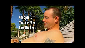 The man who lost his penis