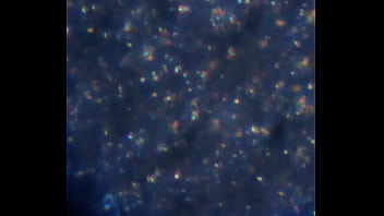 Examen de mis nadadores semen