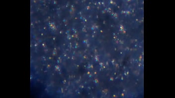 Examen de mis nadadores semen