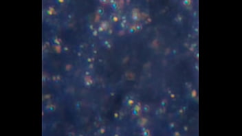 Examen de mis nadadores semen