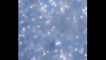 Examen de mis nadadores semen