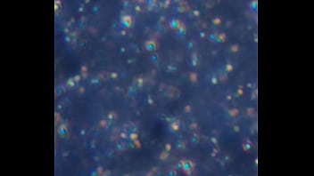 Examen de mis nadadores semen