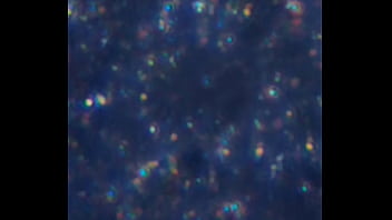 Examen de mis nadadores semen