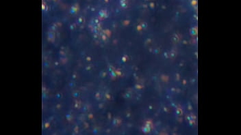 Examen de mis nadadores semen Examen de mis nadadores semen