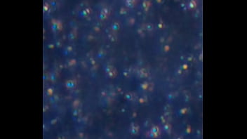 Examen de mis nadadores semen