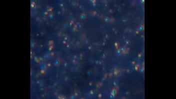 Examen de mis nadadores semen