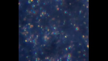 Examen de mis nadadores semen