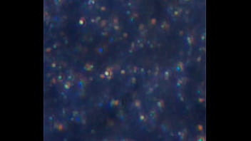 Examen de mis nadadores semen