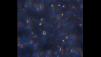 Examen de mis nadadores semen