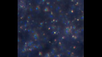 Examen De Mis Nadadores Semen thumbnail