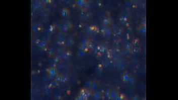 Examen de mis nadadores semen