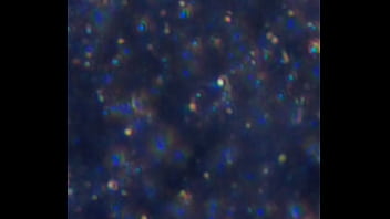 Examen de mis nadadores semen Examen de mis nadadores semen