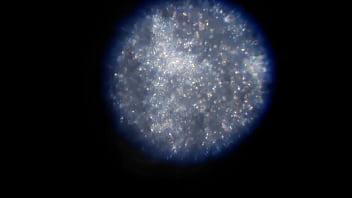 Examen de mis nadadores semen