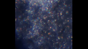 Examen de mis nadadores semen