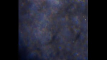 Examen de mis nadadores semen