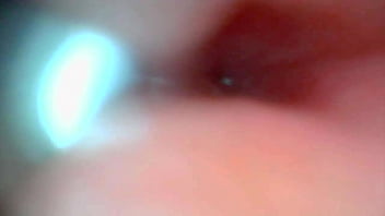 Endoscope Camera Captures Moment Of Male Ejaculation thumbnail