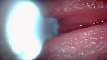 Endoscope camera captures moment of male ejaculation