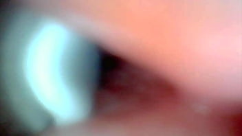 Endoscope camera captures moment of male ejaculation