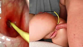 Best anal camera in her ass deep anal fuck and internal creampie