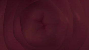 Mandela catalog break in