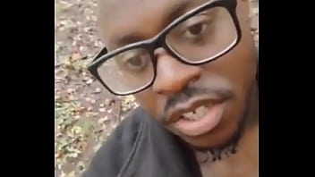 Introducing how my skin also gets sometimes when the weather gets hot and sunny in the summertime while wearing flasher coat to cover the rest of my body from developing too much allergies1