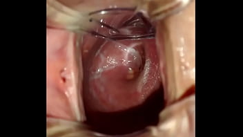 Por dentro da buceta com espéculo vaginal