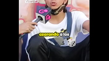 La historia detrás de mis cicatrices #vertigo #elchicletv #vida #chiclenoticias #patinetas #deporte #atrevidoypegajoso