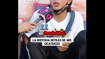 La historia detrás de mis cicatrices #vertigo #elchicletv #vida #chiclenoticias #patinetas #deporte #atrevidoypegajoso