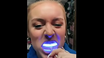 Teasy collection of teeth whitening gals and salivary