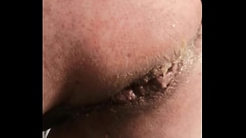 Más turbación de ano 1