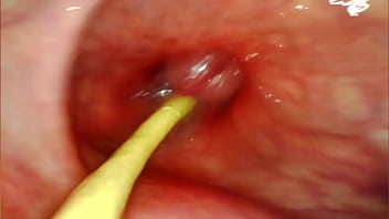 Anal pov camera inside her asshole as i pound her with my big cock and cum deep inside