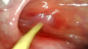 Anal pov camera inside her asshole as i pound her with my big cock and cum deep inside