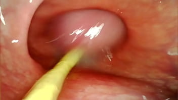 Anal pov camera inside her asshole as i pound her with my big cock and cum deep inside