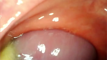 Anal pov camera inside her asshole as i pound her with my big cock and cum deep inside