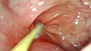 Anal pov camera inside her asshole as i pound her with my big cock and cum deep inside