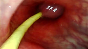 Anal pov camera inside her asshole as i pound her with my big cock and cum deep inside