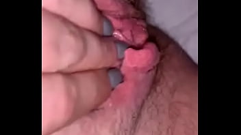 Vagina labia