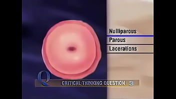 Female vagina and anus check