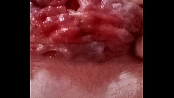 My a****** close upl