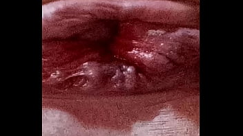 My a****** close upl