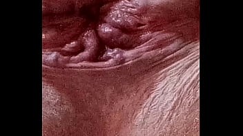 My a****** close upl